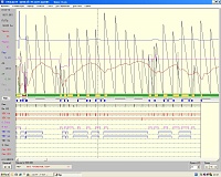 �� ����������� ���������� �� ���������.-bezymyannyi5.jpg